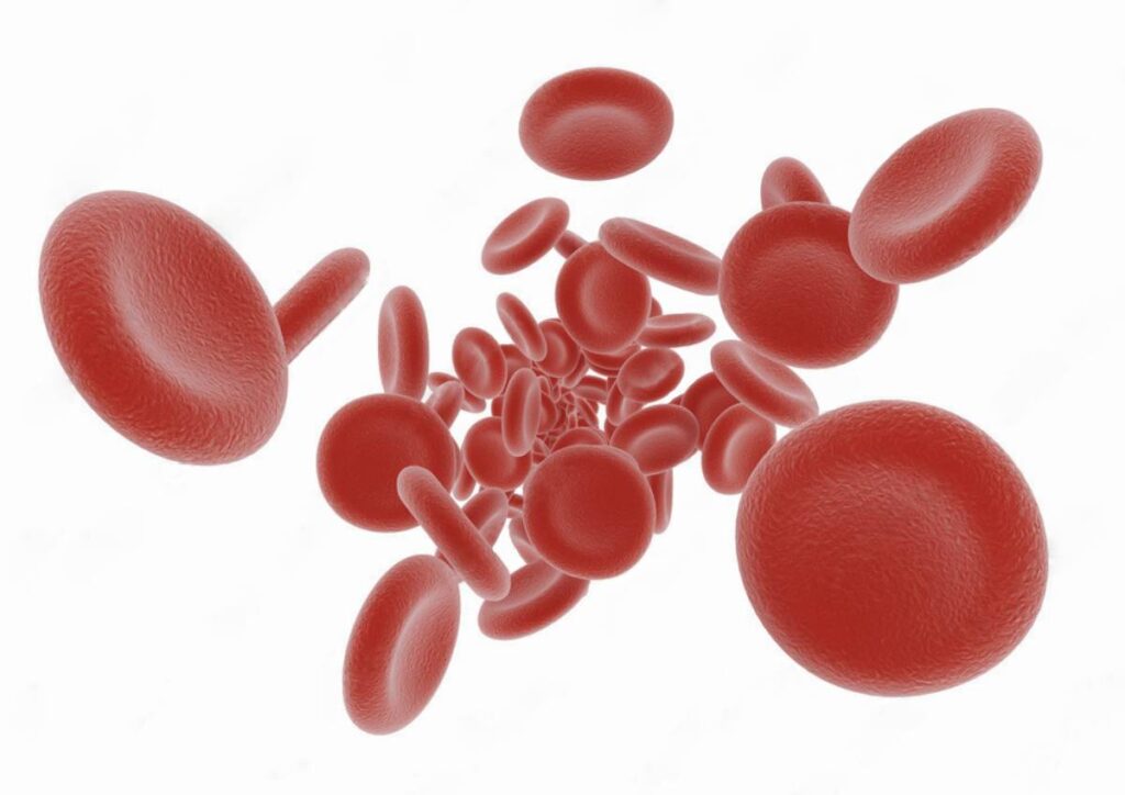 CBD anemia